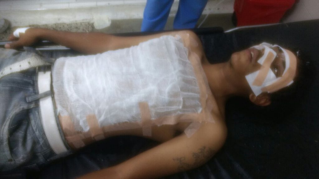 Vendedor ambulante fue víctima de ataque con ácido en el oriente de Cali