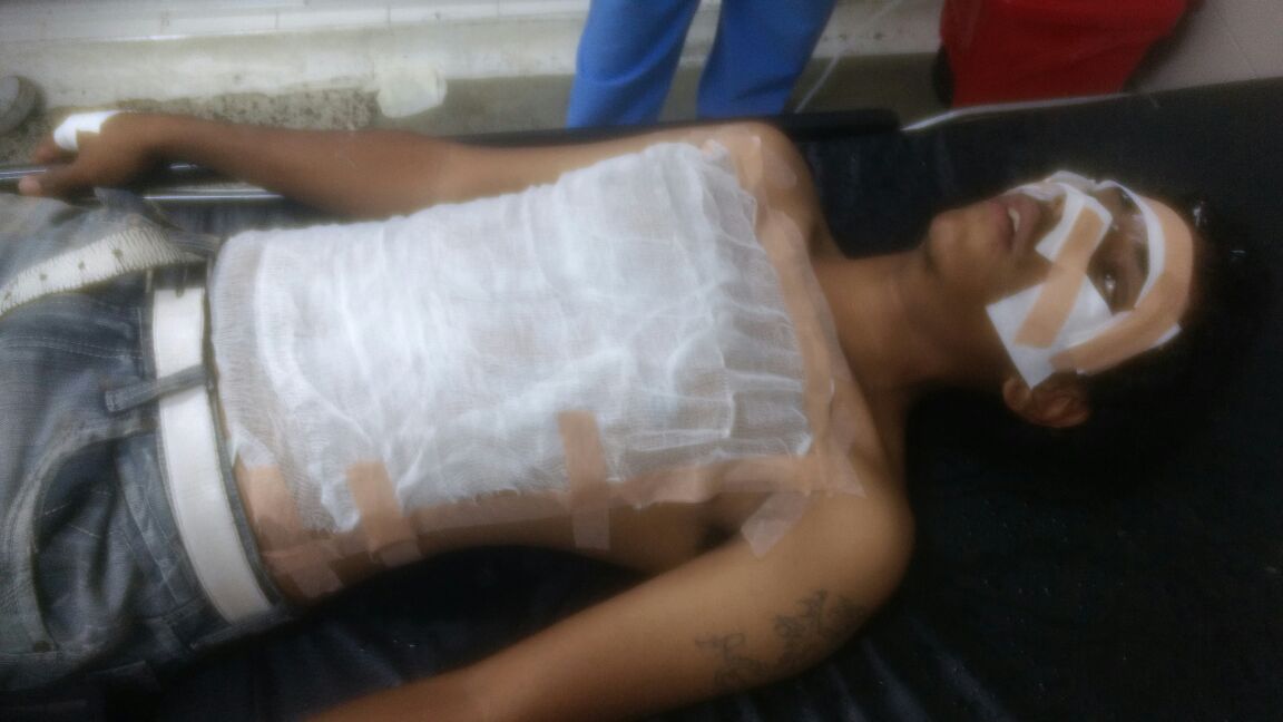 Vendedor ambulante fue víctima de ataque con ácido en el oriente de Cali