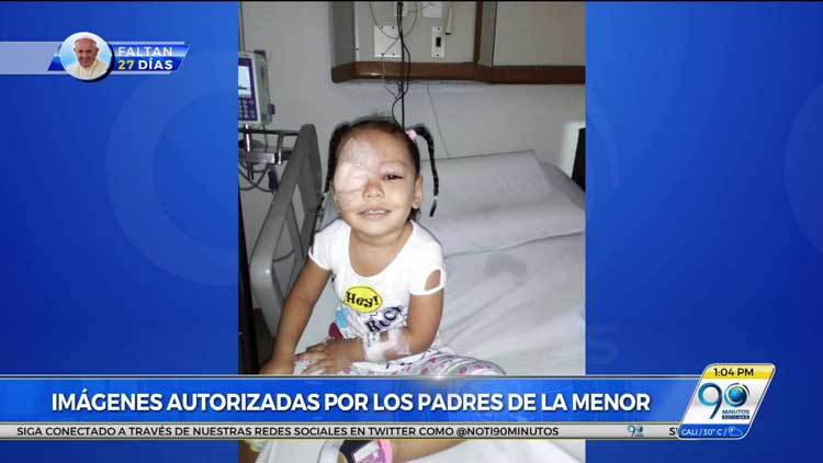Niña de 2 años perdió un ojo por mala prestación del servicio de Cafesalud