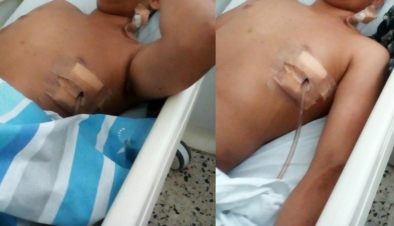 Por robarle 2.000 pesos, sujeto apuñaló a niño de 14 años en San Bosco, Cali