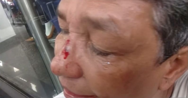 Por 30 mil pesos, gota a gota golpeó brutalmente a mujer de 60 años en Cali