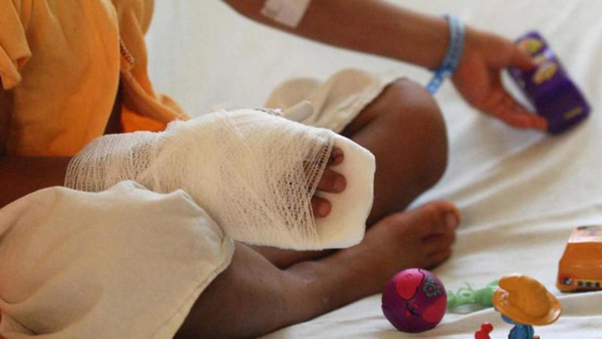 Número de personas lesionadas por pólvora en Cali y el Valle sigue creciendo