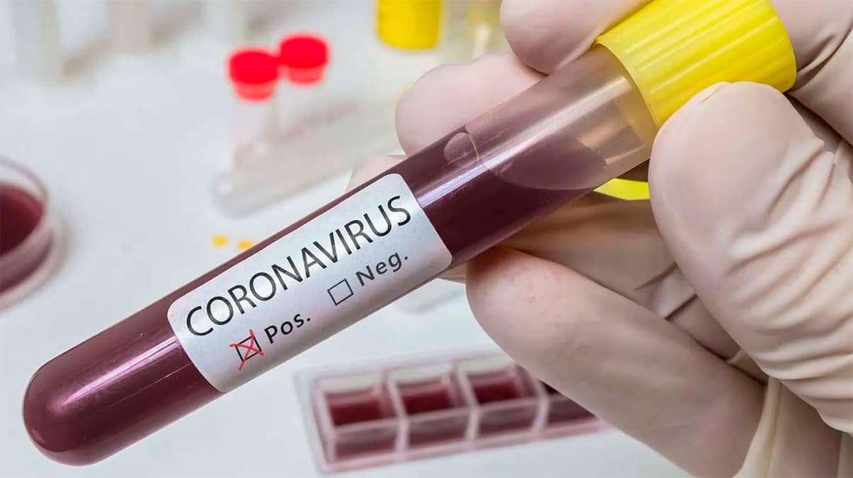 Colombia confirmó récord de 27.000 nuevos casos de coronavirus y 511 muertos