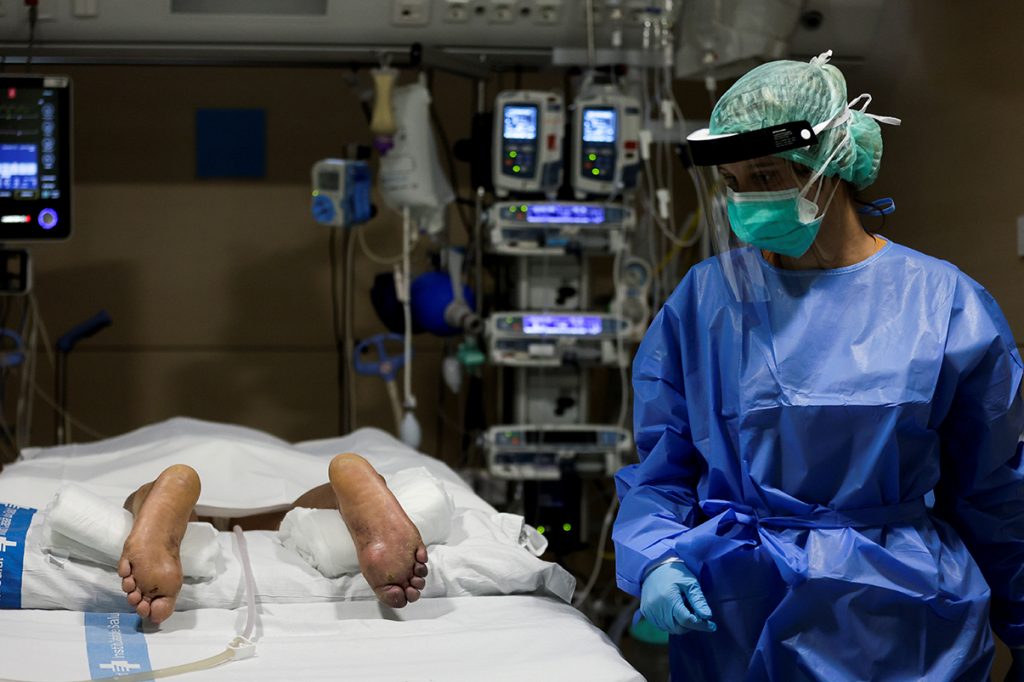 Poner a pacientes boca abajo reduce necesidad de intubación y su mortalidad