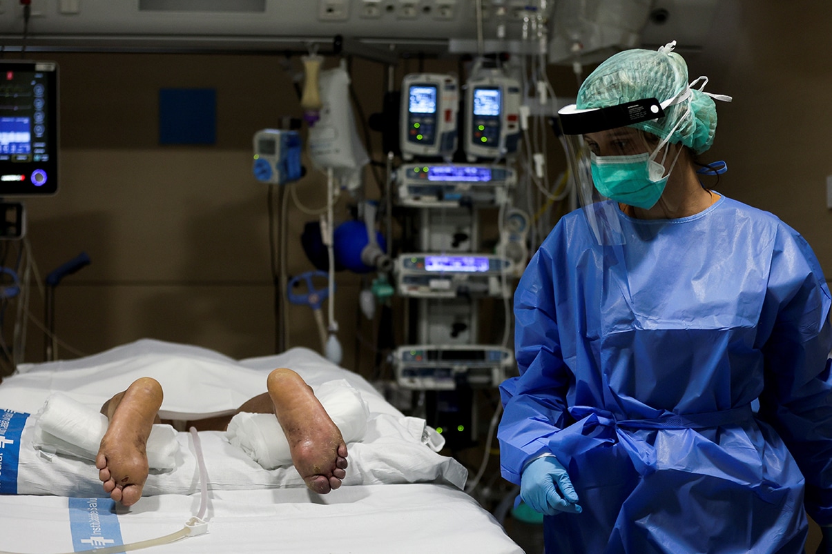 Poner a pacientes boca abajo reduce necesidad de intubación y su mortalidad