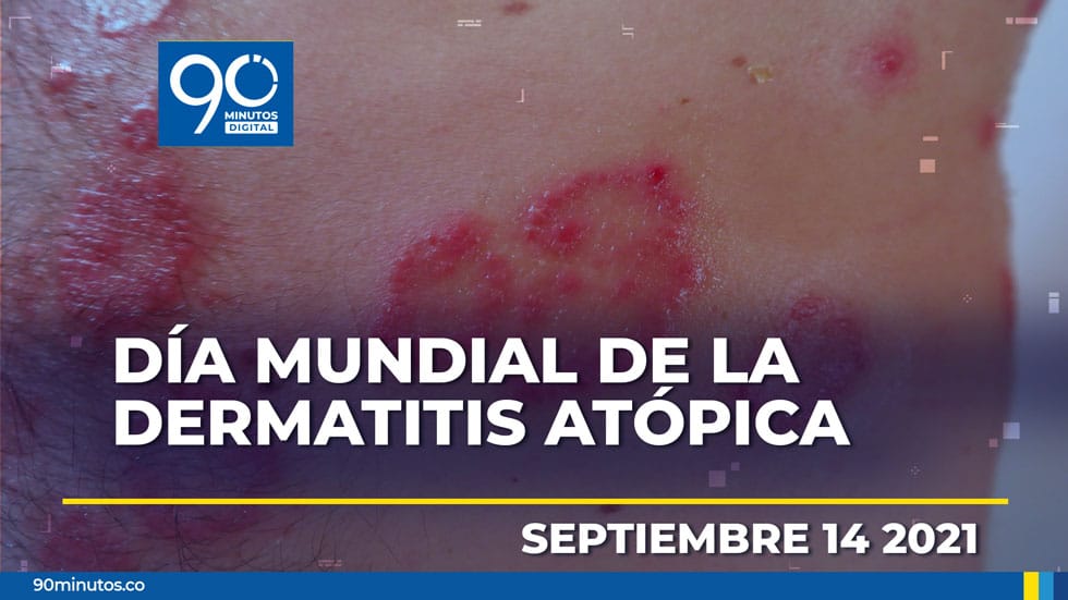 Reducir tiempos de diagnóstico en cáncer de mama y avanzado, el reto de Suramérica