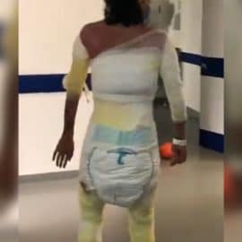 El drama que vive Laura Rincón luego de que su expareja le prendiera fuego
