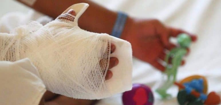Valle del Cauca: tercer departamento con más lesionados por pólvora