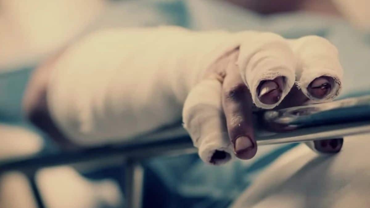 Alerta en Cali por el aumento de casos positivos de covid 19
