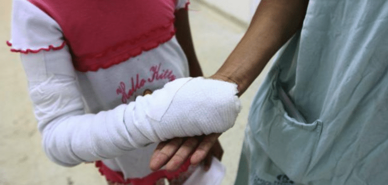 Aumenta el número de personas quemadas en el Valle del Cauca