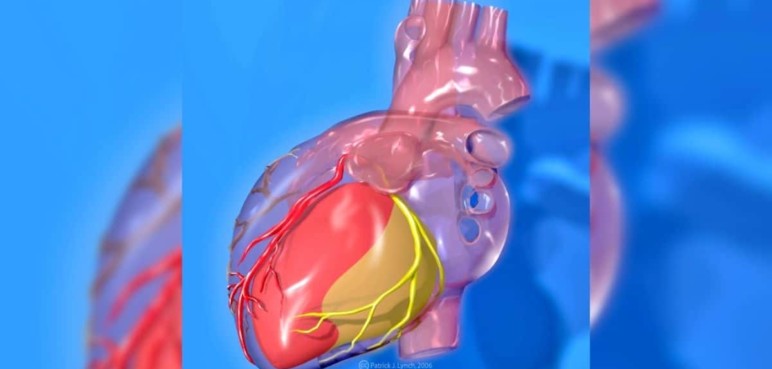 Celebración del Día de las Enfermedades Raras "Amiloidosis cardíaca"