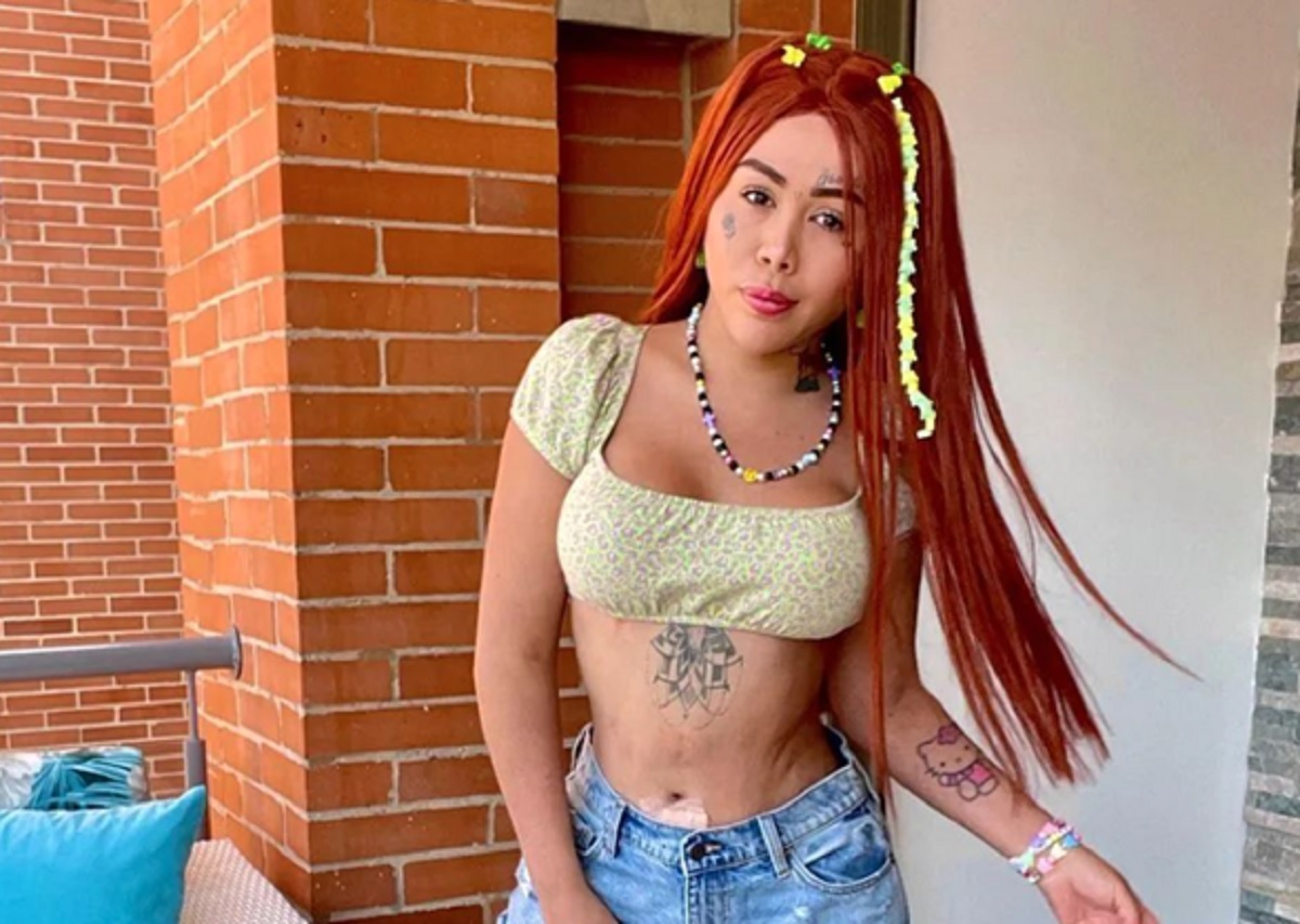 Yanfry, el "niño que camina como hombre", se encuentra hospitalizado