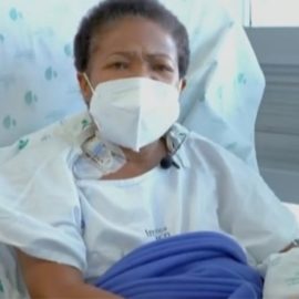 Médicos salvaron mano de profesora, tras ser cortada por ladrón en Pradera