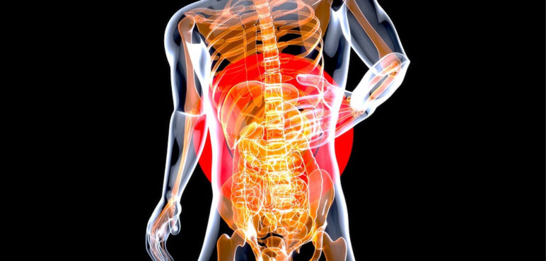 Enfermedad Inflamatoria Intestinal: Atención preventiva es un aspecto esencial