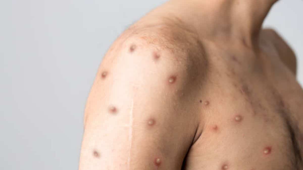 Inician las entregas de incentivos para beneficiarios de 'Jóvenes en Acción'