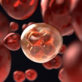Cada minuto importa tras un diagnóstico de cáncer de sangre