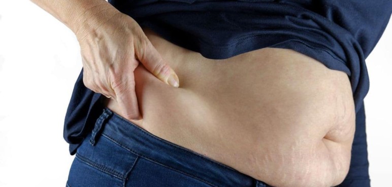 HUV estrena programa que atiende a personas que presentan obesidad