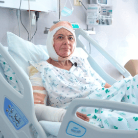Mujer que sufrió quemaduras en el 80% de su cuerpo se recuperó exitosamente