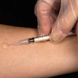 Cada año, hay 2,5 millones de nuevos casos de meningitis