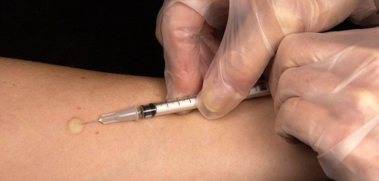 Cada año, hay 2,5 millones de nuevos casos de meningitis