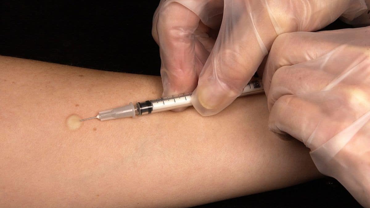 Cada año, hay 2,5 millones de nuevos casos de meningitis