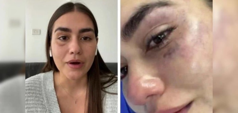 Presunto agresor de la diseñadora caleña Johana Rojas quedó en libertad