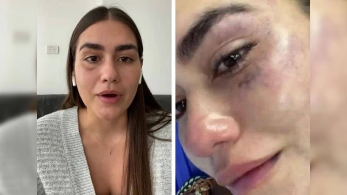 Presunto agresor de la diseñadora caleña Johana Rojas quedó en libertad