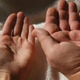 Acromegalia: 90% de los casos son a causa de un tumor benigno en la hipófisis