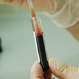 Este miércoles Hospital Universitario realiza jornada de pruebas gratis de VIH