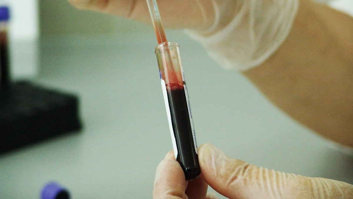 Este miércoles Hospital Universitario realiza jornada de pruebas gratis de VIH