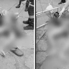 Adulto mayor resultó gravemente herido luego de que una volqueta chocara con él