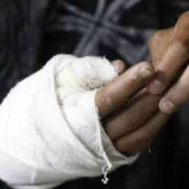 Alborada navideña dejó cuatro personas lesionadas por pólvora en el Valle