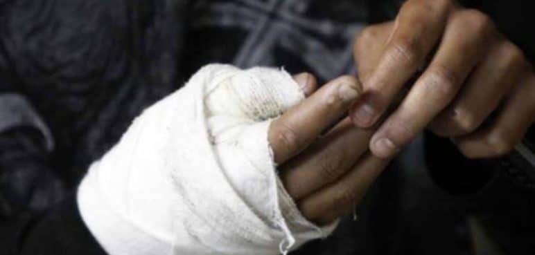Alborada navideña dejó cuatro personas lesionadas por pólvora en el Valle