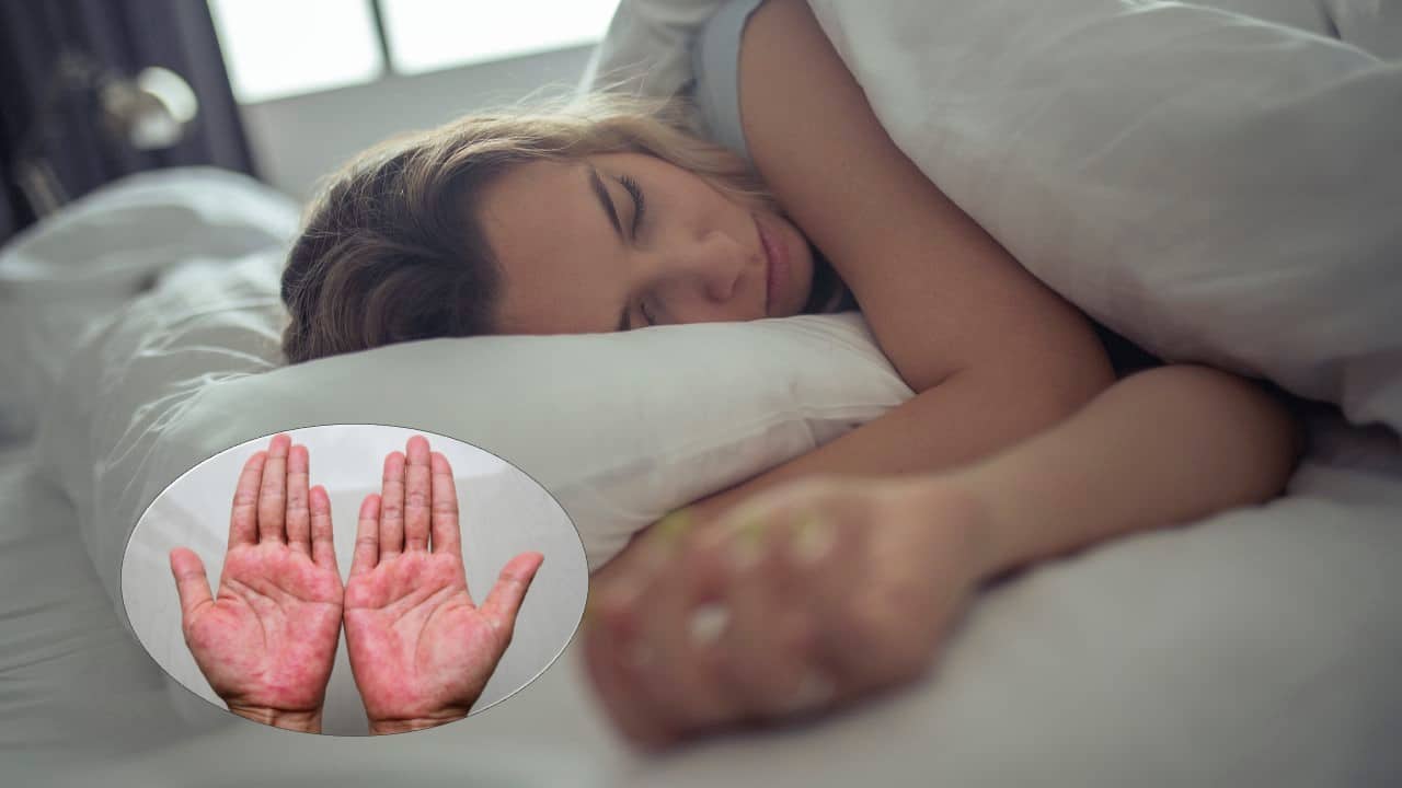 Día mundial del sueño: Conozca la relación entre dormir y la Dermatitis