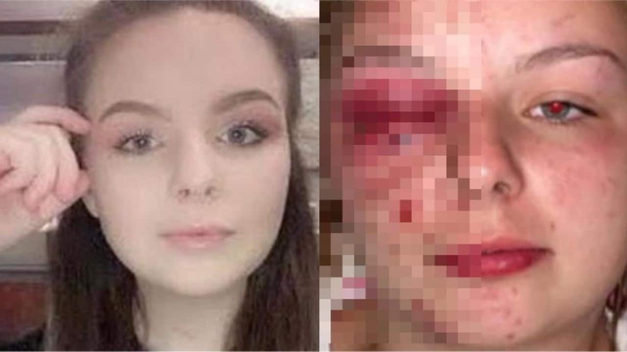 Crece indignación por mujer que fingió su violación y se golpeó con un martillo