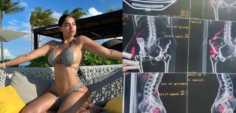 “Está podrido”: La Segura expone el proceso de su cuerpo tras los biopolímeros