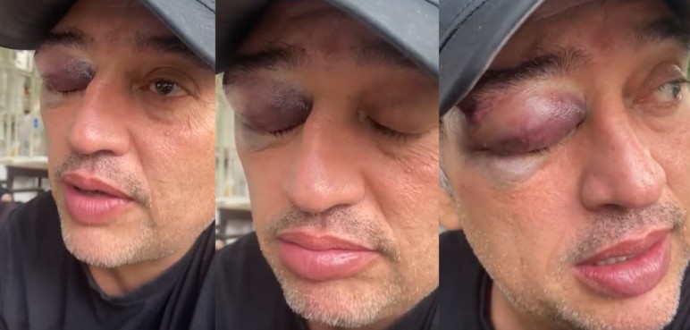 Hijo de Rodolfo Hernández fue golpeado fuertemente por un ciudadano