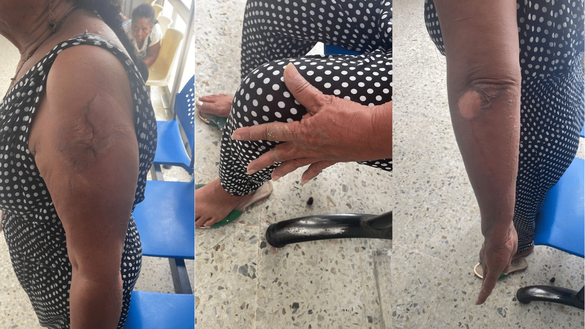Indignante: Un hombre le prendió fuego a su pareja porque ella terminó la relación