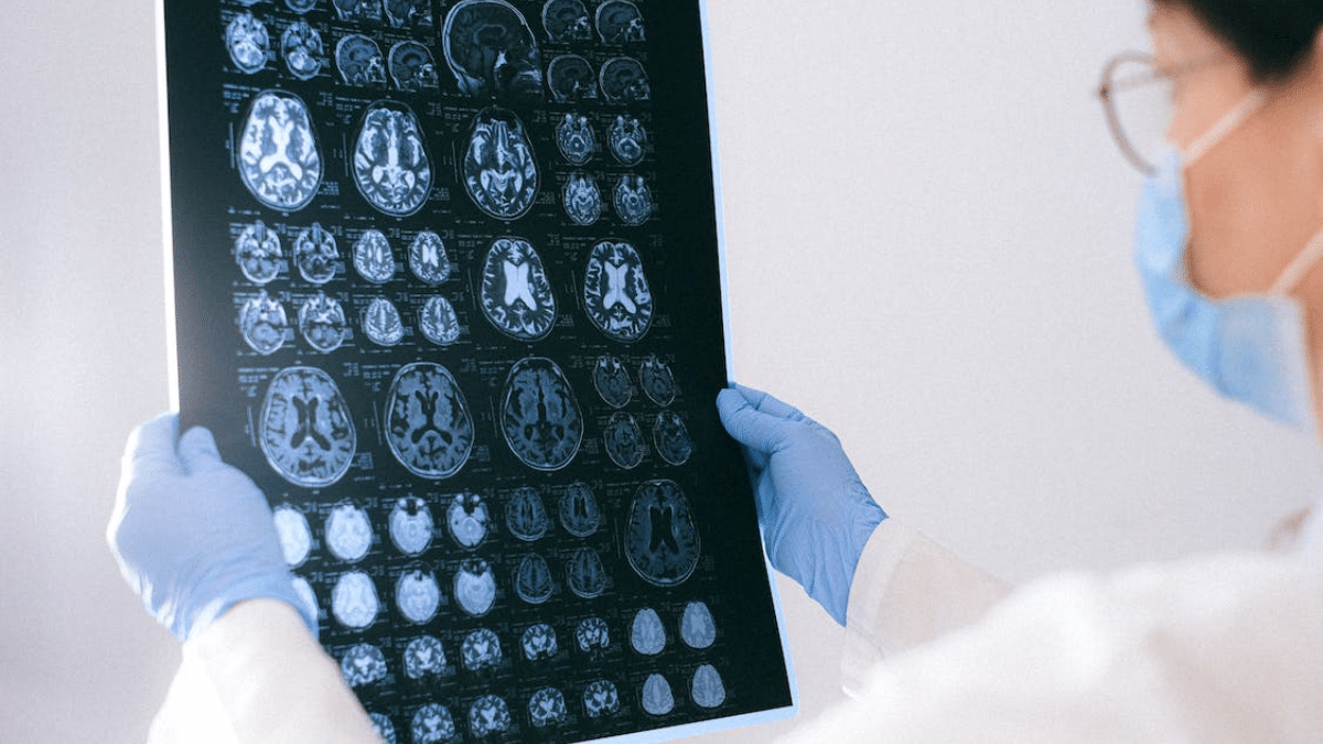 "Es indispensable vigilar el virus del Covid-19": OMS