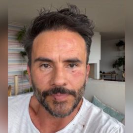 "Uno de ellos intentó agarrar a mi hija": Juan Pablo Raba tras ser víctima de robo