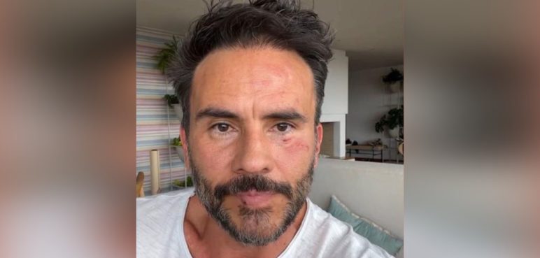 "Uno de ellos intentó agarrar a mi hija": Juan Pablo Raba tras ser víctima de robo