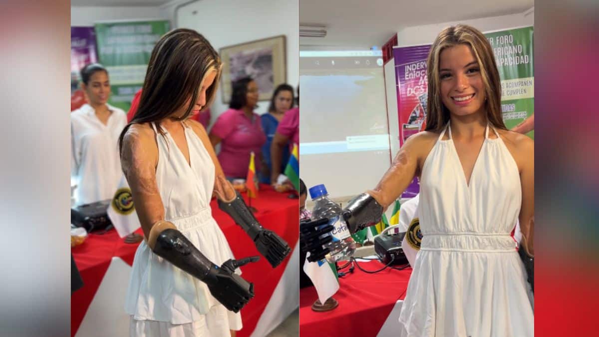 Karol Bastidas, ejemplo e inspiración: la deportista ya tiene sus prótesis robóticas