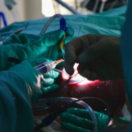 cirugía fetal inutero