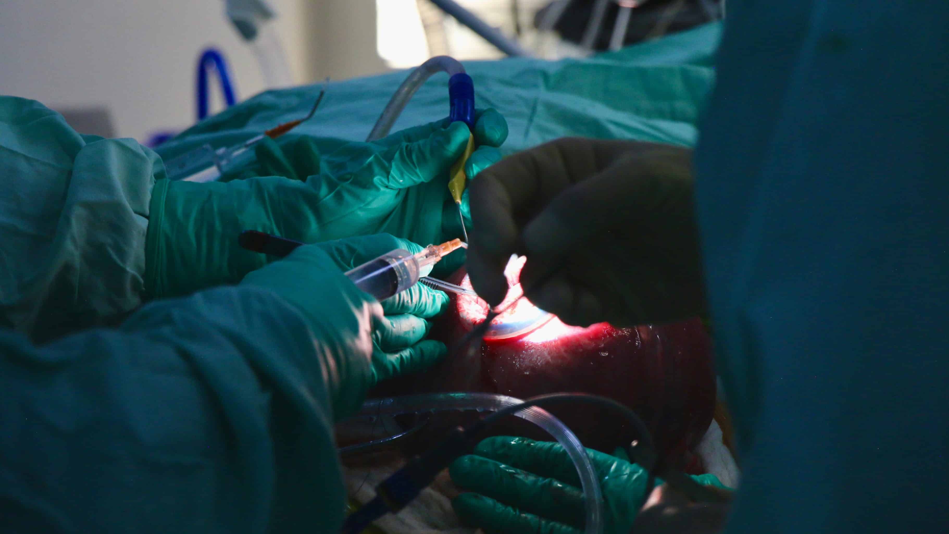 cirugía fetal inutero